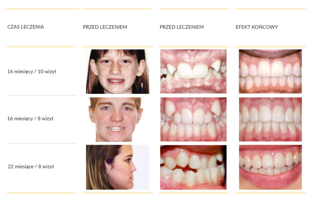 ortodoncja kraków - RÓŻNI PAJENCI, INNY CZAS I ILOŚĆ WIZYT